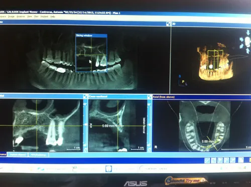 3D imaging can be used for treatment planning