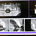 3D imaging