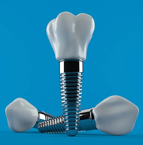 Dental,Implant